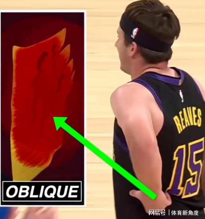 东契奇与里夫斯欧洲疗伤引争议 美国专家质疑治